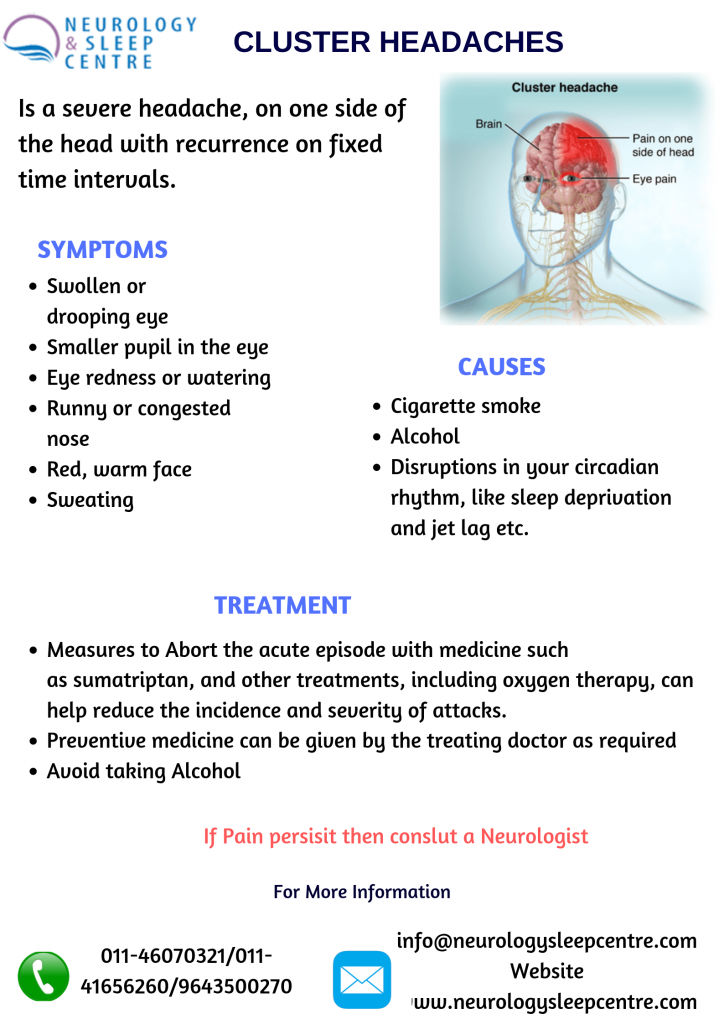 cluster-headaches-causes-symptoms-treatment